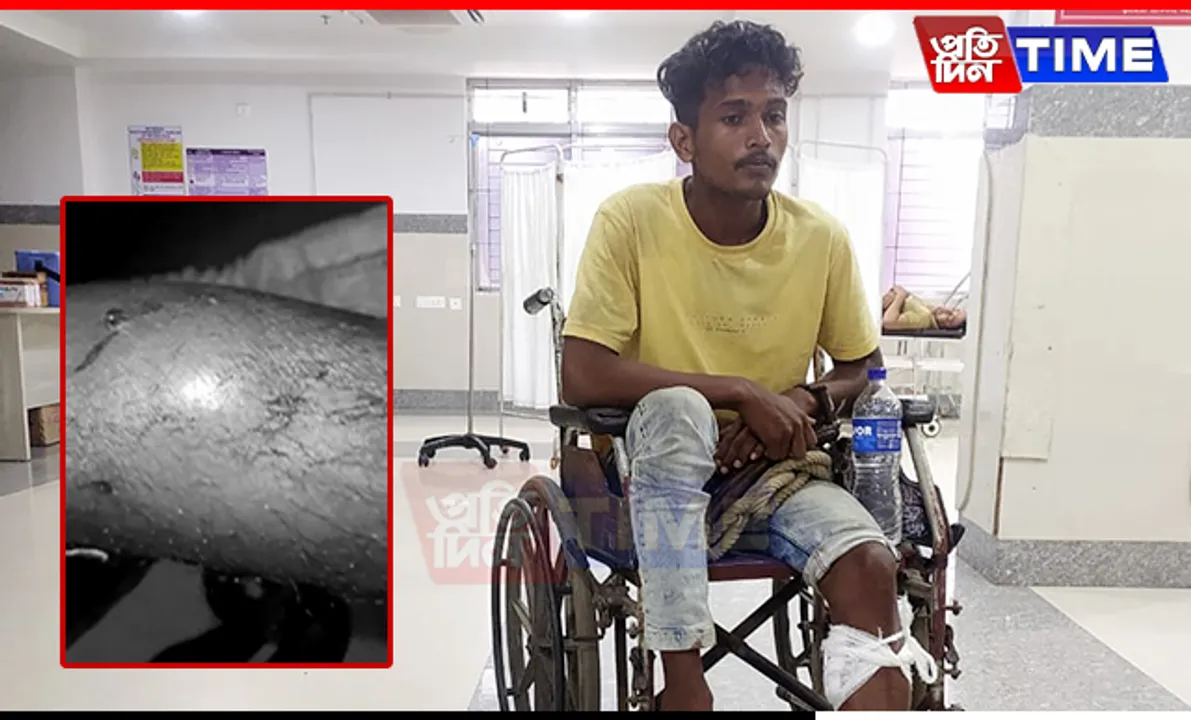 Assam Teen Murder: Accused Tries to Escape Police Custody, Injured in Police Firing